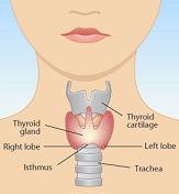 How to Treat Hypothyroidism Naturally