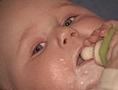 Signs of Lactose Intolerance in Babies