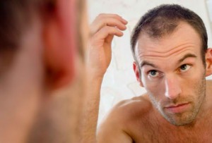 man with thinning hair