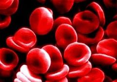 Thalassemia causes, signs and symptoms, treatment