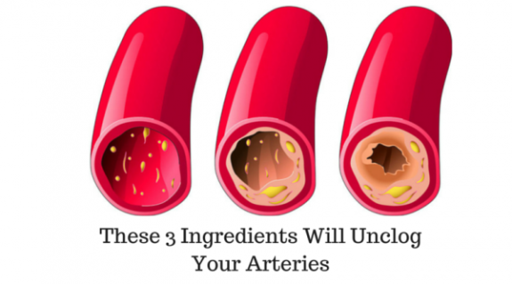 These 3 Ingredients Will Unclog Your Arteries